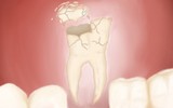 Slorrow's Tooth